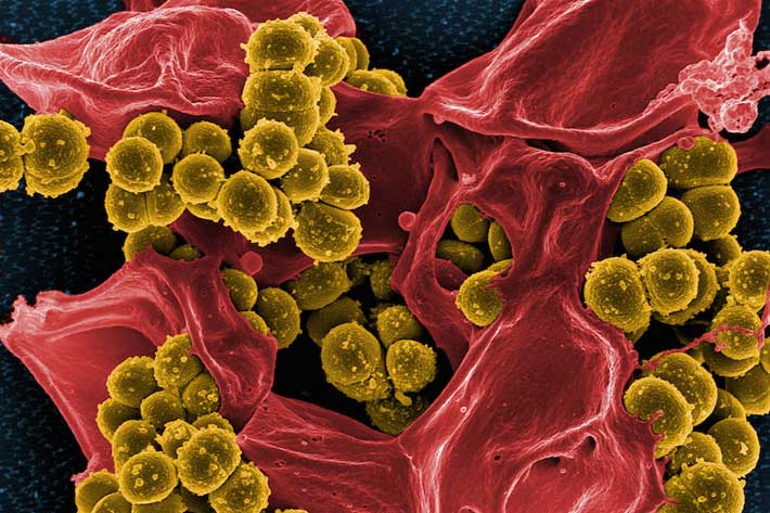 Researchers Identify Nasal Bacteria to Combat Staph, MRSA