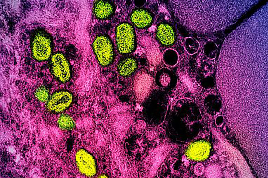 Colorized transmission electron micrograph of monkeypox particles (green) found within an infected cell (pink and purple), cultured in the laboratory.