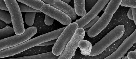 Scanning electron micrograph of Escherichia coli, grown in culture and adhered to a coverslip