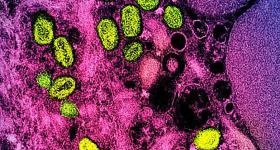 Colorized transmission electron micrograph of monkeypox particles (green) found within an infected cell (pink and purple), cultured in the laboratory.